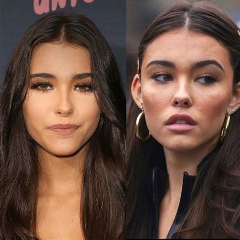 madison beer plastic sugery|Madison Beer Responds to Plastic Surgery Rumors